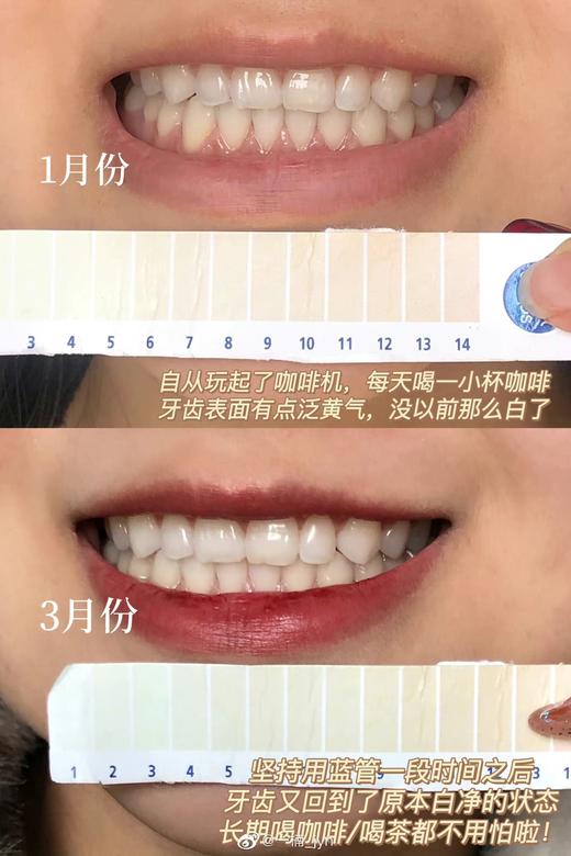 跳水价必囤！！！贝嫂同款！pearldrops倍洁丽去牙渍美白牙膏100g 商品图5