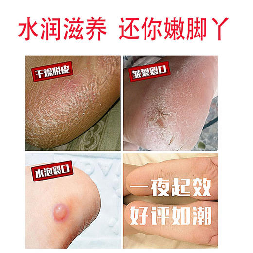 防脚后跟裂袜子脚干燥开裂脱皮保健袜子女足裂全脚防裂口袜子皲裂 商品图5