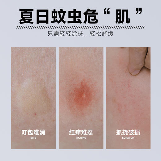【买二送一！紫草舒润膏】一抹解忧无刺激，使用更放心！身材小巧，外出游玩随身常备，温和驱蚊止痒，舒爽清凉提紫草膏！告别蚊虫！母婴可用 商品图2