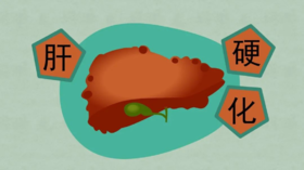  体检查出“脂肪肝”伴有肝纤维化没注意，4年后肝硬化差点成肝癌！ 