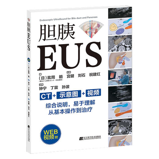 胆胰EUS CT示意图视频从操作到治疗 判断乳头部肿瘤浸润进展程度 血管浸润评估 祝建红 等译9787559123251辽宁科学技术出版社 商品图1