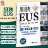胆胰EUS CT示意图视频从操作到治疗 判断乳头部肿瘤浸润进展程度 血管浸润评估 祝建红 等译9787559123251辽宁科学技术出版社 商品缩略图0