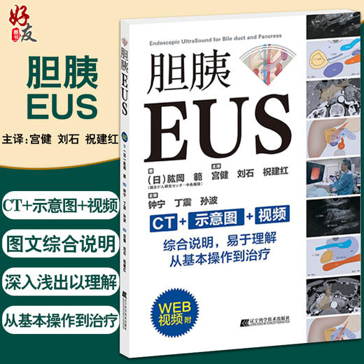 胆胰EUS CT示意图视频从操作到治疗 判断乳头部肿瘤浸润进展程度 血管浸润评估 祝建红 等译9787559123251辽宁科学技术出版社 商品图0
