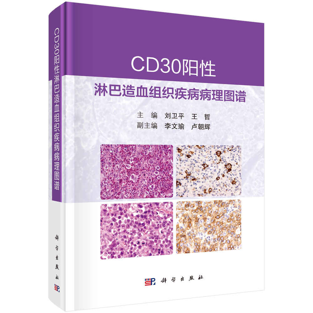 CD30阳性淋巴造血组织疾病病理图谱/刘卫平 王哲