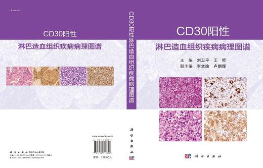 CD30阳性淋巴造血组织疾病病理图谱/刘卫平 王哲 商品图2