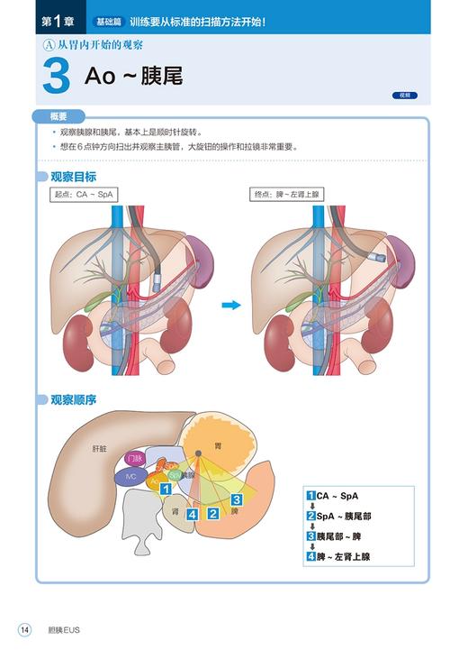 胆胰EUS CT示意图视频从操作到治疗 判断乳头部肿瘤浸润进展程度 血管浸润评估 祝建红 等译9787559123251辽宁科学技术出版社 商品图4