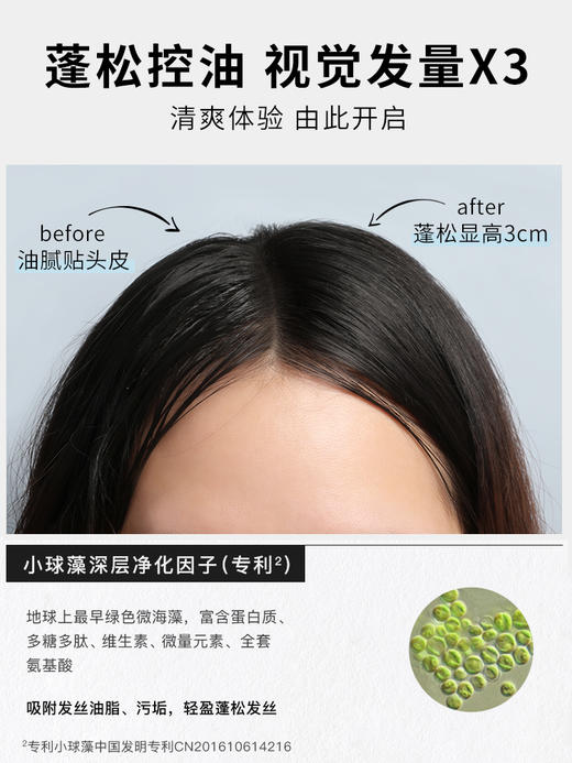 如薇净透控油洗发水护发素rnw洗发水控油蓬松去屑止痒官方旗舰氨基酸柔顺改善毛躁洗头露膏 商品图4