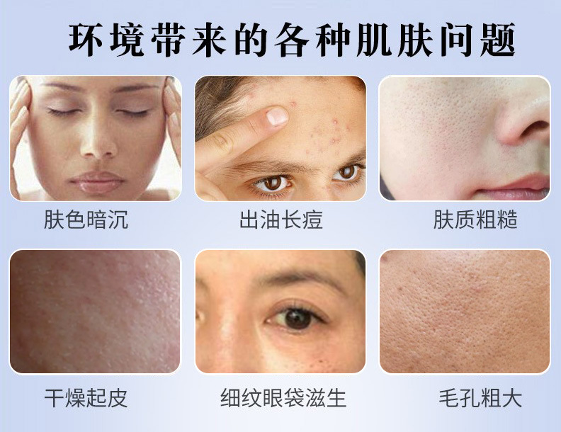 各种肤质问题  要上传