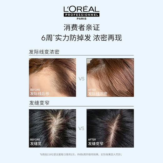 法国L'oreal欧莱雅芯基源丰盈育发精华液 90ML  商品图3