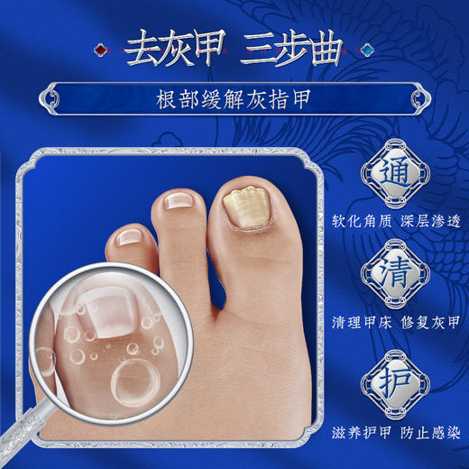 灰指甲修护液 深层渗透去指甲板浑浊脱落增厚变脆滋养甲板美甲液 商品图1