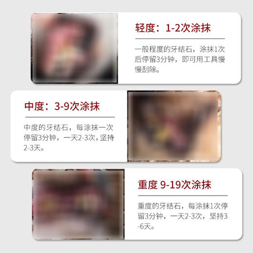 kojima宠物猫咪狗狗洁牙笔牙结石去除器口臭口腔牙齿水清洁工具 商品图3