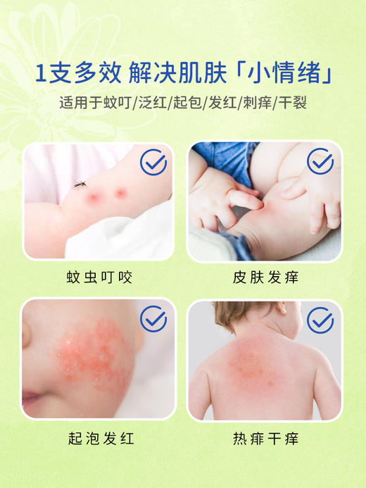 Boiron宝弘金盏花止痒膏儿童婴儿宝宝蚊虫叮咬止痒cicaderma软膏 商品图1