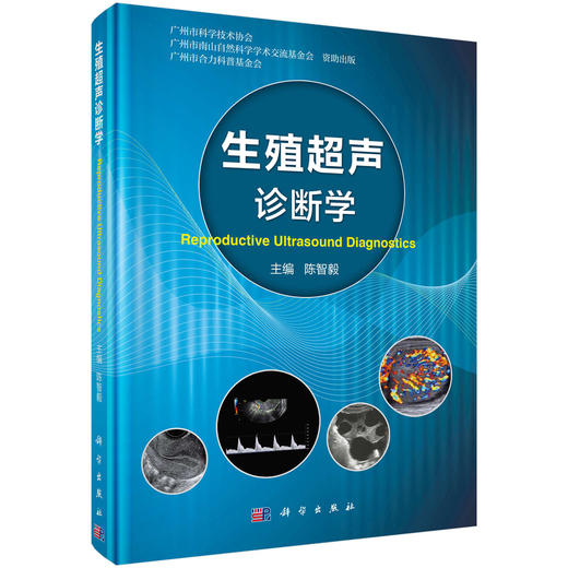 生殖超声诊断学/陈智毅 商品图0
