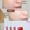 敷尔佳淡斑一盒5片 商品缩略图2