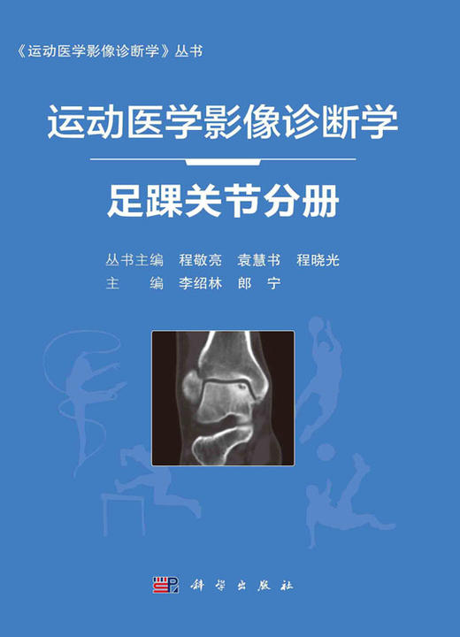 运动医学影像诊断学 足踝关节分册 足踝关节运动损伤的类型及特点 相应解剖部位常见运动损伤影像表现 李绍林 朗宁 9787030682512 商品图2