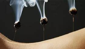 夏天艾灸三穴位，扶阳祛湿调气血（女性必看） 