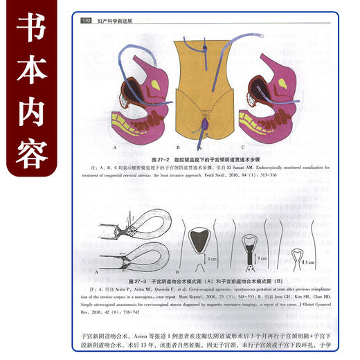 妇产科学新进展2021 郎景和 妇科肿瘤疾病产科疾病普通妇科疾病生殖内分泌与生育调控疾病 中华医学电子音像出版社9787830053444 商品图4