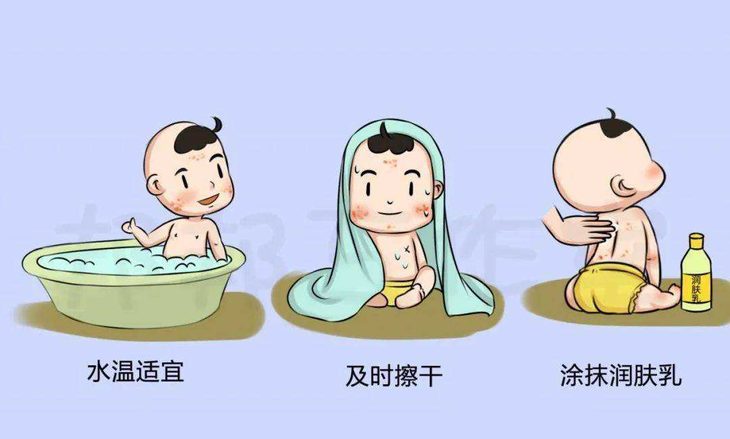 痱子和湿疹如何正确护理?