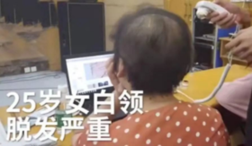  用这一招，让你发量重回20岁！ 