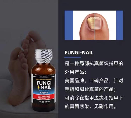 特价198元🉐包税包邮到手了🔥Fungi-Nail Anti-Fungal 灰指甲脚气癣治疗液，30Ml 商品图5