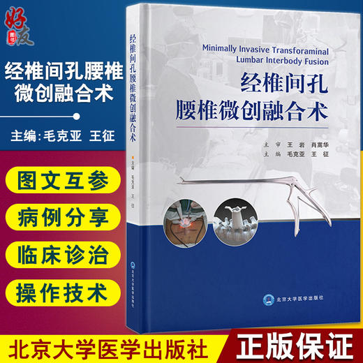 经椎间孔腰椎微创融合术 毛克亚 王征 腰椎脊柱病 显微外科学 临床应用MIS-TLIF的实践和体会 9787565920356北京大学医学出版社 商品图0