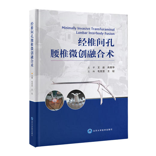 经椎间孔腰椎微创融合术 毛克亚 王征 腰椎脊柱病 显微外科学 临床应用MIS-TLIF的实践和体会 9787565920356北京大学医学出版社 商品图1