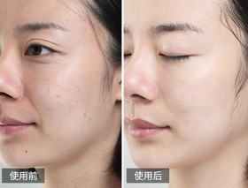 给跪了！一个颠覆性抗衰突破：300道尔顿液体黄金……