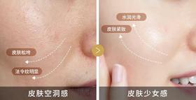 皮肤空洞自我检测：这些症状但凡中招一个，瞬间老5岁！