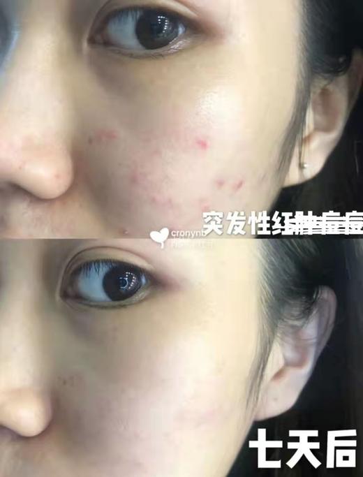 最大容量60ml特价！扛焱界天花板！Phyto-c欧玛油橄榄精华凝胶GEL舒缓退红修护3.75ml/30ml/60ml 商品图5