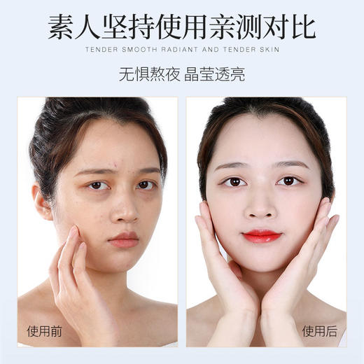 【好物推荐~超值2盒20片！！！】阿古丽娅糙米面膜学生党男女补水保湿去黄提亮肤色收缩毛孔孕妇可用国货面膜大米 商品图7