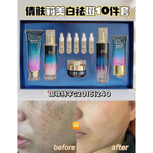 【倩肤莉】水感清润美白祛斑套装 10件套 商品图1