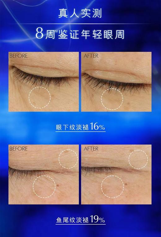 雅诗兰黛小棕瓶特润修护精华眼霜15ml熬夜蓝光眼霜淡化细纹黑眼圈护肤品 商品图5