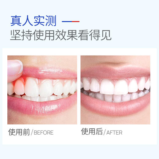 口腔脱敏膏 120g 商品图3