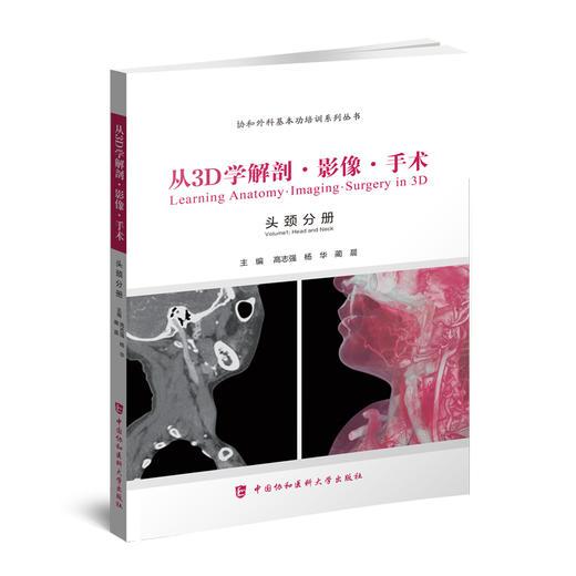 从3D学解剖影像手术头颈分册 协和外科基本功培训系列丛书 高志强 杨华 蔺晨 颈部动脉血管树中国协和医科大学出版社9787567908499 商品图1