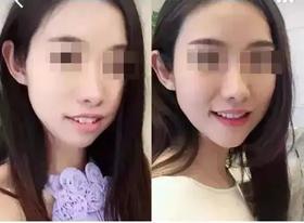  盘点那些坑了无数人的牙科虚假宣传... 