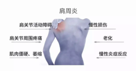  艾灸腿上一个穴，解冻你的“肩周炎”！ 