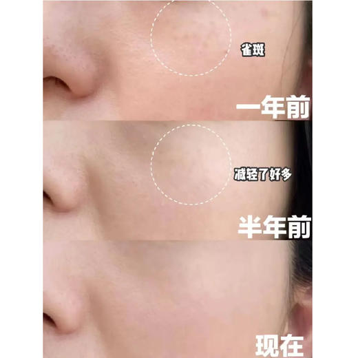 【新品】西班牙BELLA AURORA BIO10 祛斑美白精华30ML（23.5） 商品图1