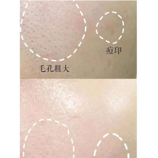 【新品】西班牙BELLA AURORA BIO10 祛斑美白精华30ML（23.5） 商品图4