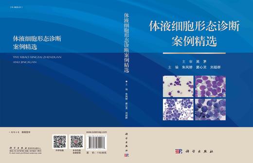 体液细胞形态诊断案例精选/朱凤娇 窦心灵 刘超群 商品图2
