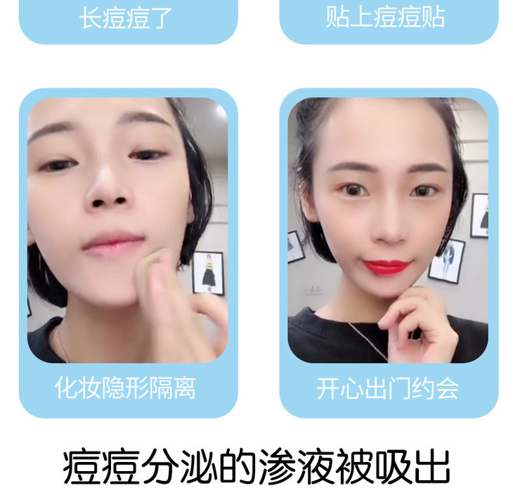 伊维尔净痘贴详情页_09.jpg