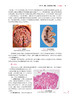 病理学与病理生理学 第五5版 十四五规划教材全国高等学校教材 供本科护理学类专业用 步宏 王雯人民卫生出版社9787117327404 商品缩略图4