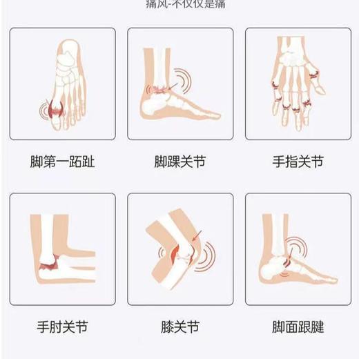 【无惧酸高 关节舒畅】芹菜籽葵花粉片 关节不痛灵活如风 辅助绛尿酸缓解痛风 绛酸片清酸青酸茶100片/瓶 商品图3