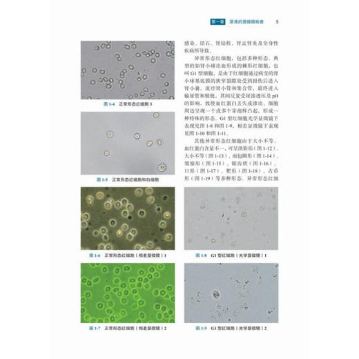 现货 临床体液及排泄物形态学检查图谱 第2版 供临床检验工作者及医学院校师生参考 王前 郑磊 孙德华 编 9787030683496科学出版社 商品图4