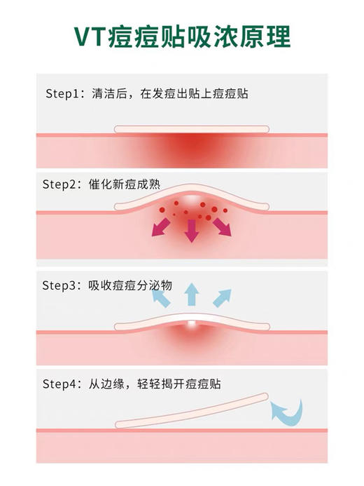 VT老虎痘痘贴 第三代升级 商品图4