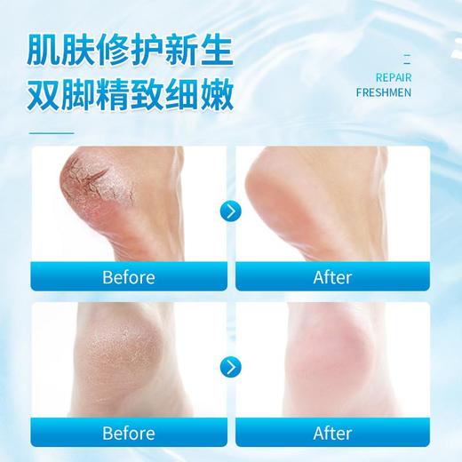 2瓶立减20元、第3瓶半价【专攻顽固踋气】英国原装进囗，持久溶箘，快速清肤，远离烂踋，修护干裂粗糙坏皮，天然温和清爽 商品图8