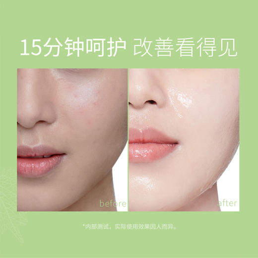 【活动价￥19.91/3盒 ￥29.9/5盒】透蜜 积雪草水嫩焕颜面膜5片/盒 商品图2
