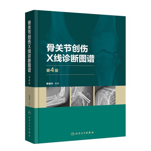 骨关节创伤X线诊断图谱（第4版） 9787117328548 商品图0