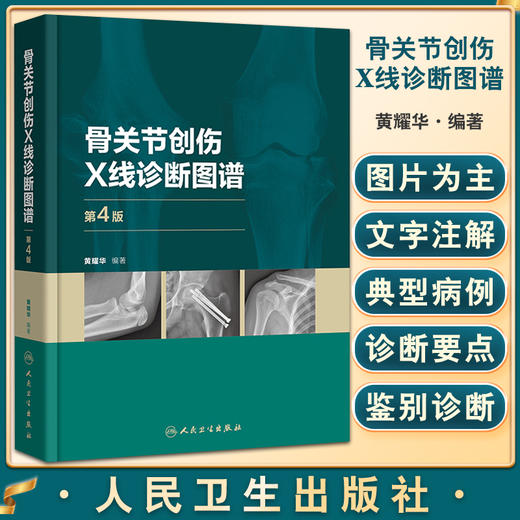 骨关节创伤X线诊断图谱 第4版 黄耀华 骨外科学创伤类型鉴别诊断常见骨关节创伤后遗症及并发症 人民卫生出版社9787117328548 商品图0