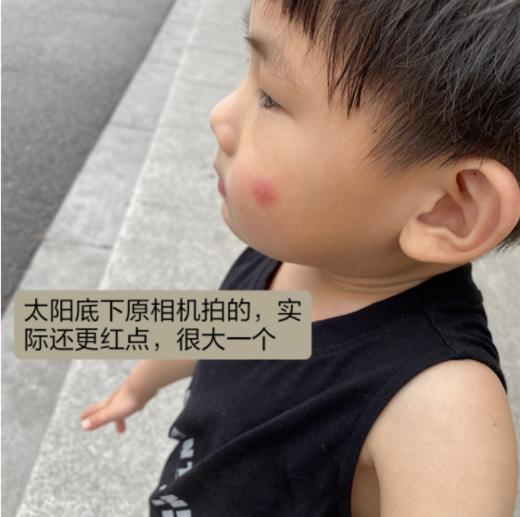 【驱蚊止痒】季德胜天然艾叶蚊虫叮咬止痒喷雾喷剂 非花露水产品健肤水30ml 商品图6