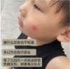 【驱蚊止痒】季德胜天然艾叶蚊虫叮咬止痒喷雾喷剂 非花露水产品健肤水30ml 商品缩略图5